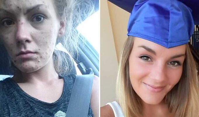 Young woman gets her diploma after overcoming heroin and meth addiction—she shares her journey in pictures
