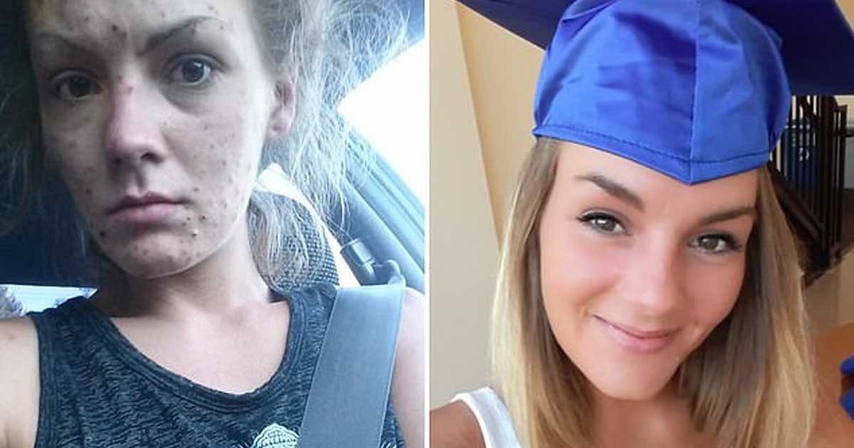 Young woman gets her diploma after overcoming heroin and meth addiction—she shares her journey in pictures