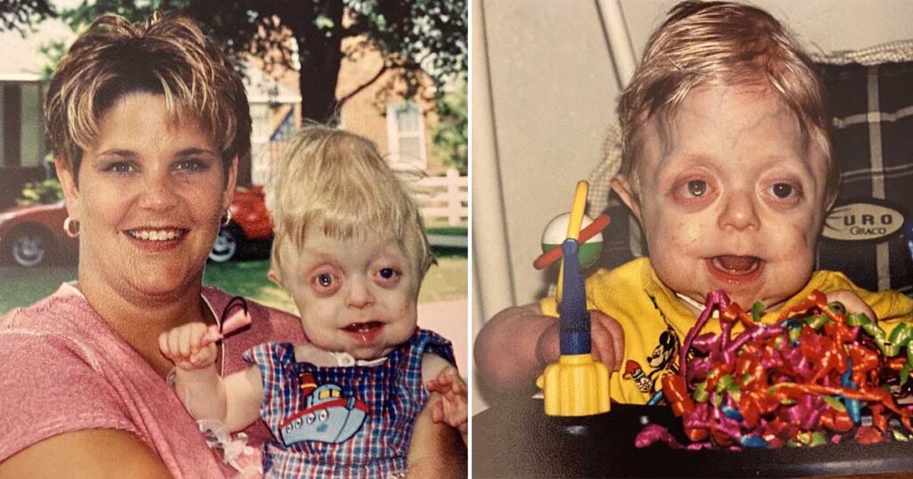 Teen who doctors didn’t think would live more than 18 months graduates high school