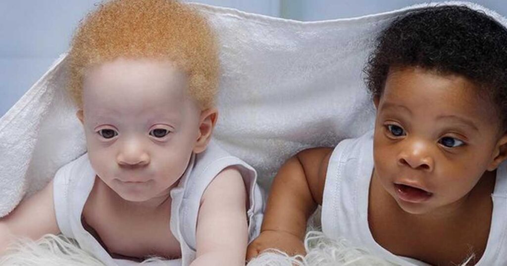 Mom of black and white boys often gets asked which one of them is hers