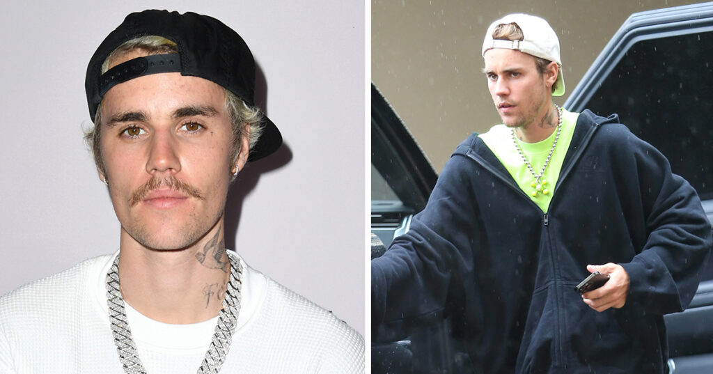 Justin Bieber shares new image of his face after diagnosis of paralyzing condition
