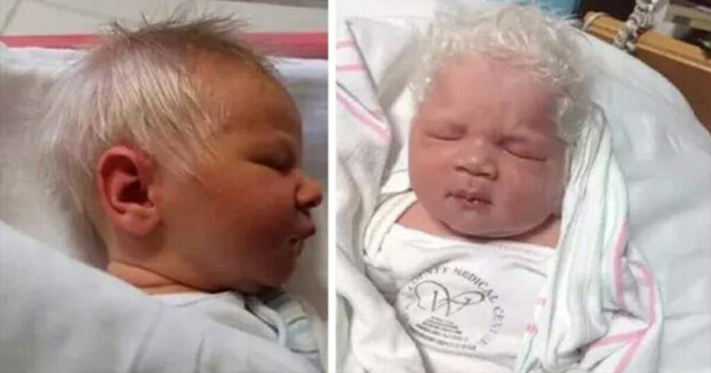 Baby born with a full head of gray hair wins everyone’s hearts