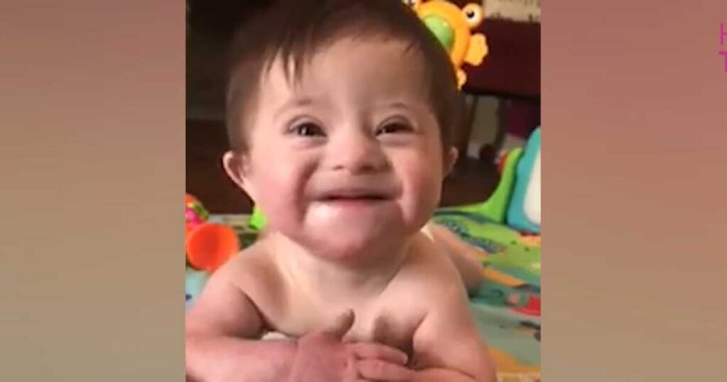Video of adopted baby with Down syndrome smiling for her new mom goes viral