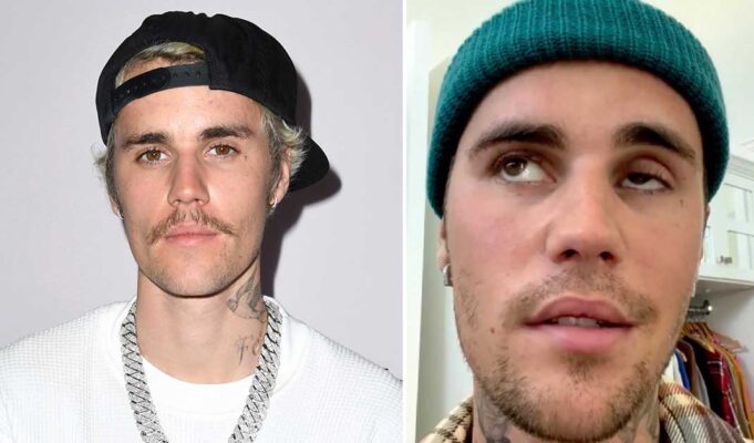 Justin Bieber shares sad health update after confirming condition last year