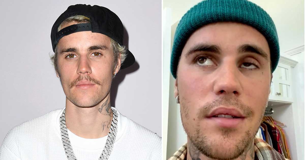 Justin Bieber shares sad health update after confirming condition last year