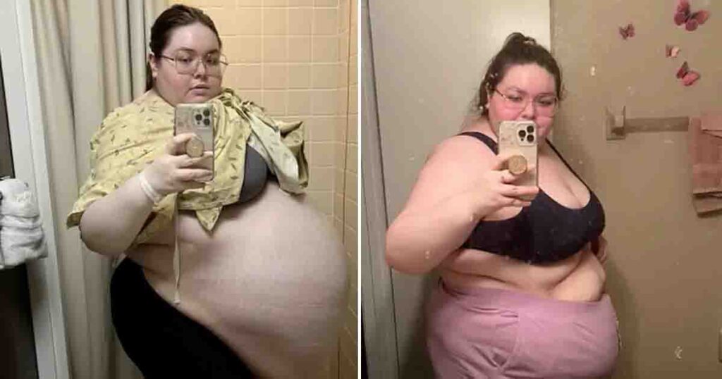 Her belly was growing larger and larger—doctors were surprised when they saw what came out of her