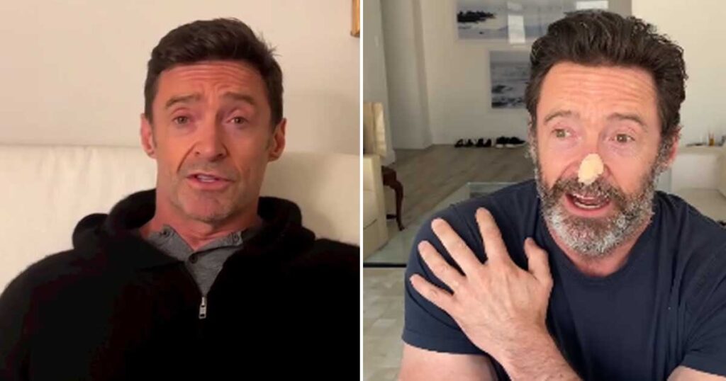 Hugh Jackman reveals the truth following the confirmation of a new cancer scare