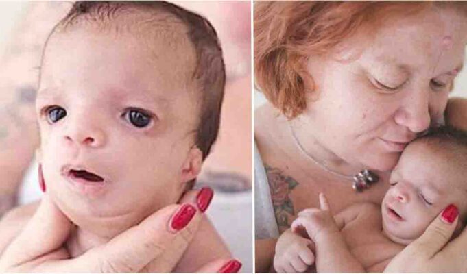Mom delivers baby with uncommon condition, baffled when adoptive family won't accept her