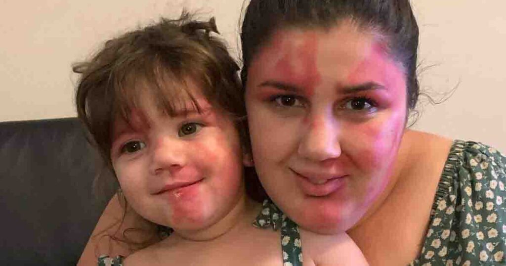 Baby once called ‘ugly’ is now a beautiful little girl