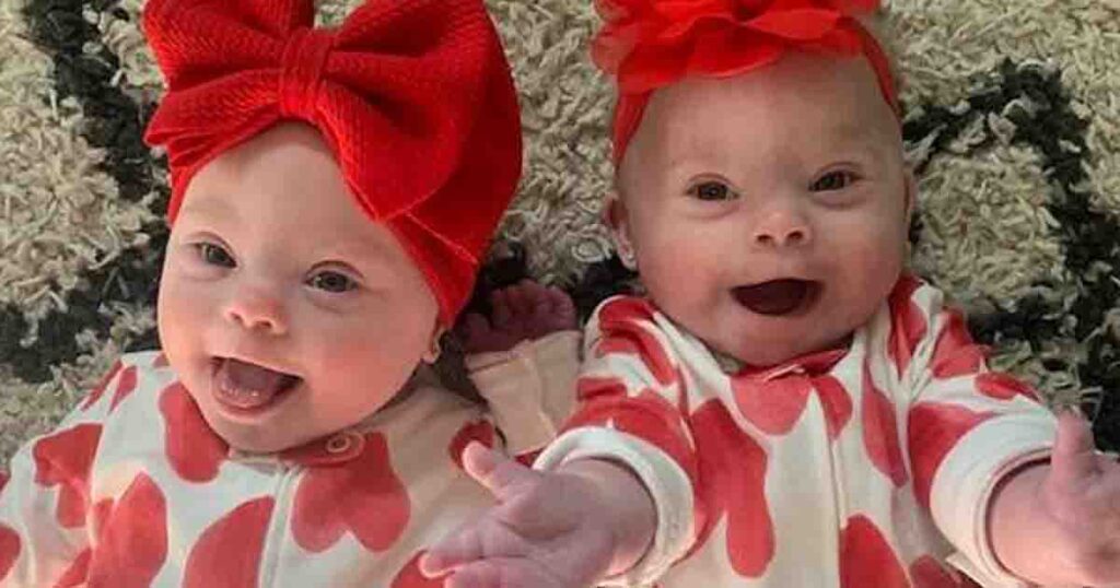 Florida woman delivers rare set of identical twins with Down syndrome