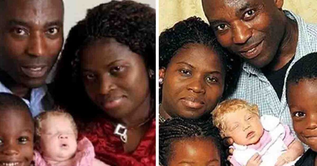 Black couple give birth to blonde, blue-eyed baby who they call ‘a miracle baby’