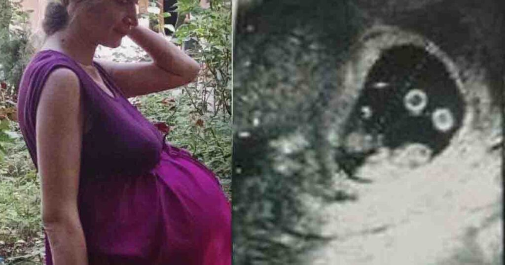 Historic pregnancy leaves everyone in the delivery room stunned