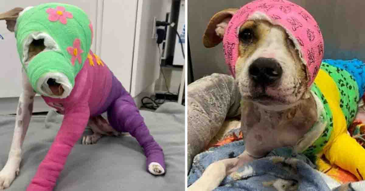 Riona was horribly set on fire—after a year of healing, she's finally headed to her new home