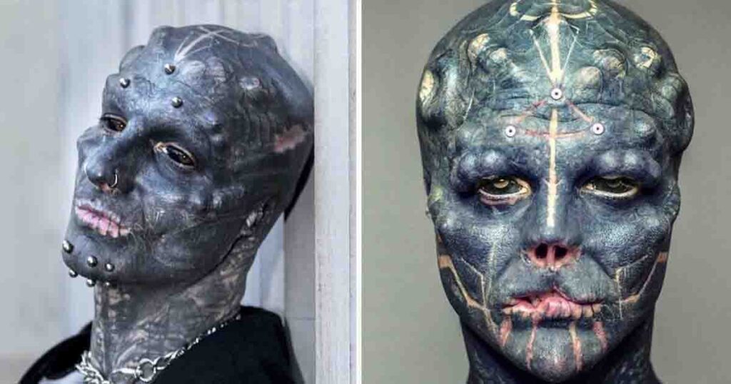 The ‘World’s most modified man’ took off two fingers to look more like a ‘Black Alien’
