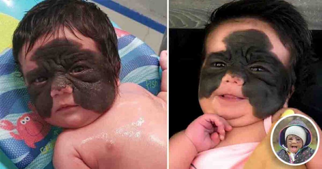 Luna Fenne—The brave young girl who keeps motivating everyone