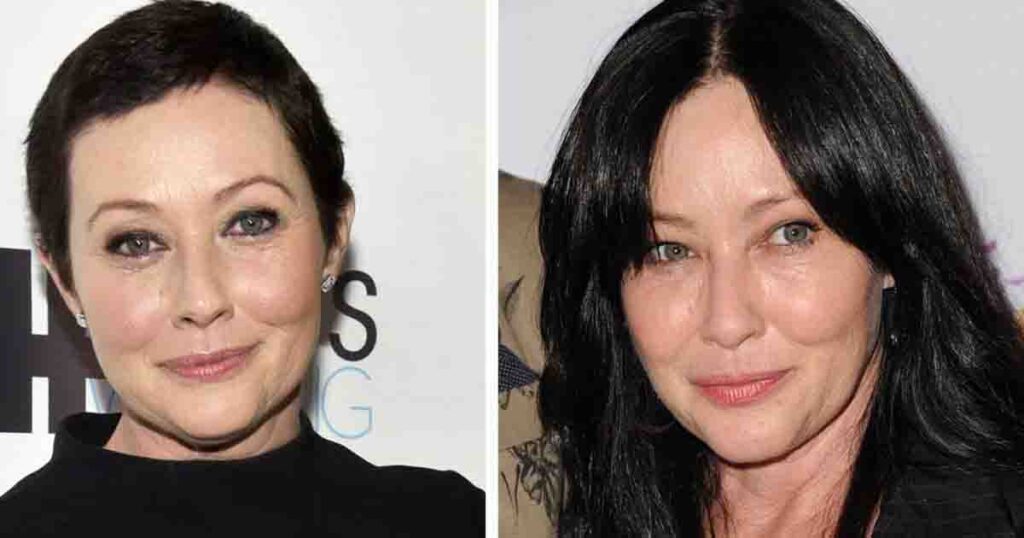 Shannen Doherty shares a close-up of her fight with cancer—‘This is what cancer can look like’