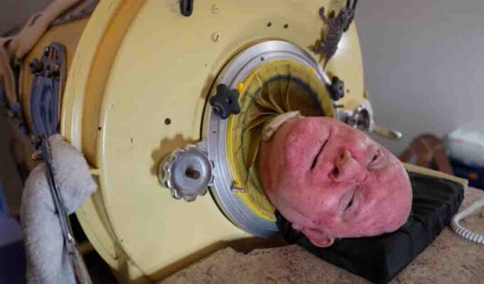 76-year-old man who paralyzed from polio at 6, is one of the last people with an iron lung—‘My life is incredible’