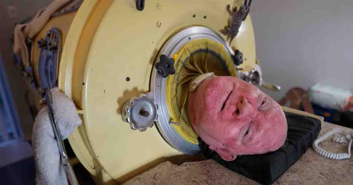 76-year-old man who paralyzed from polio at 6, is one of the last people with an iron lung—‘My life is incredible’