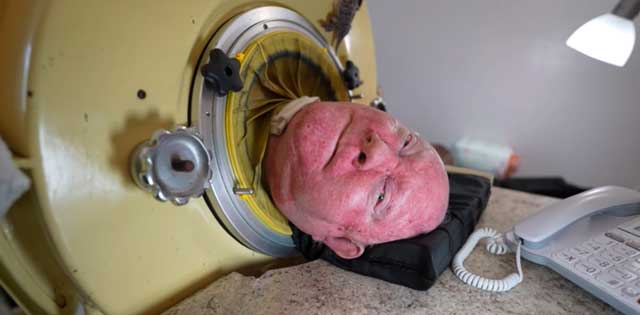 76-year-old man who paralyzed from polio at 6, is one of the last people with an iron lung—‘My life is incredible’