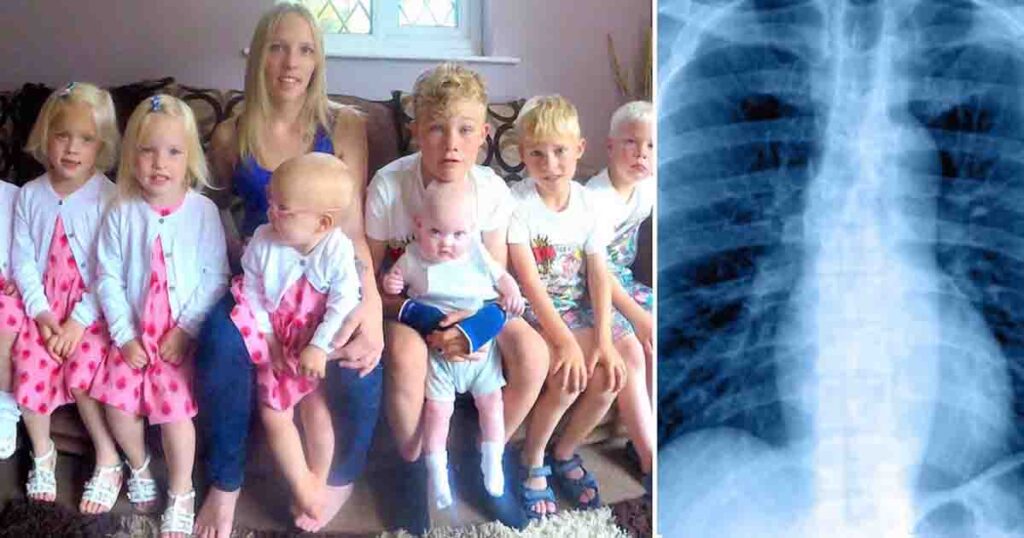 Dad passes away leaving mom with 8 kids—his hidden disease was overlooked by everyone