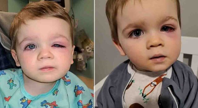 Mother warns others following incident where toddler almost lost eyesight due to a bath toy mishap