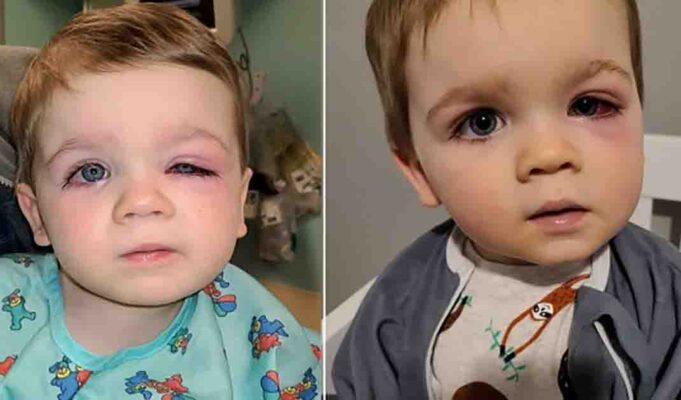 Mother warns others following incident where toddler almost lost eyesight due to a bath toy mishap