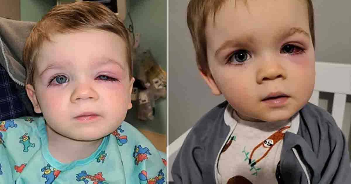 Mother warns others following incident where toddler almost lost eyesight due to a bath toy mishap