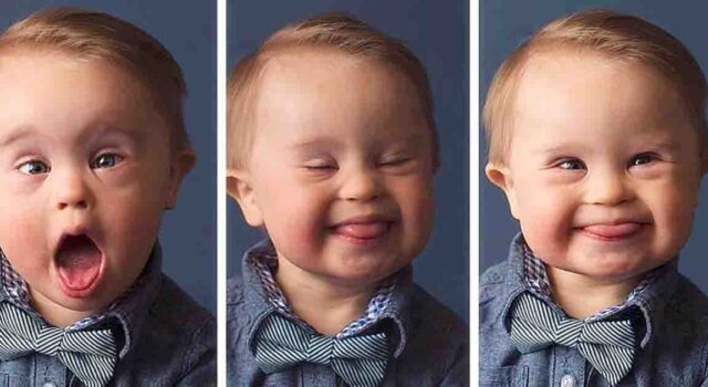 Agency denies request for boy with Down syndrome to model their clothes