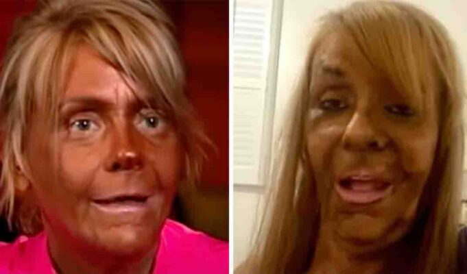 Patricia Krentcil who tanned five days a week and nearly lost her life is now known as "Tan Mom"—here's how she looks today