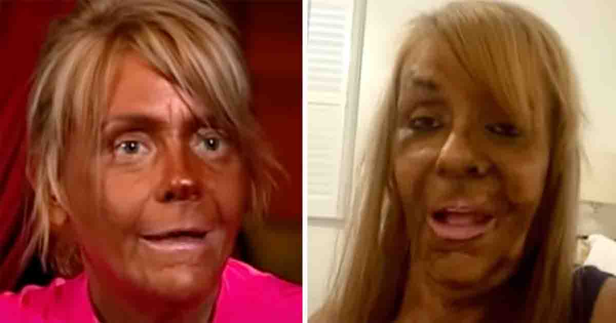 Patricia Krentcil who tanned five days a week and nearly lost her life is now known as "Tan Mom"—here's how she looks today