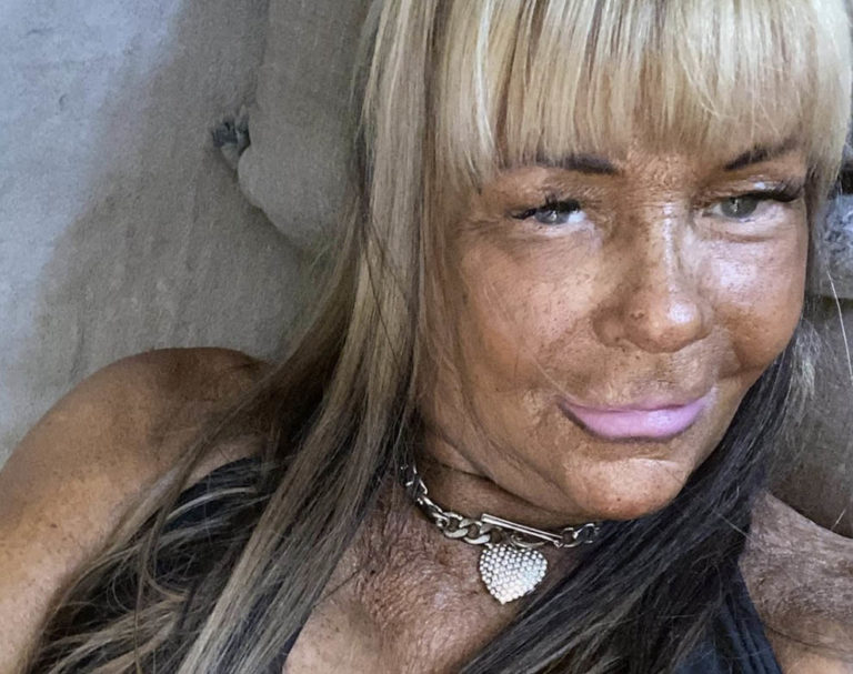 Patricia Krentcil who tanned five days a week and nearly lost her life is now known as "Tan Mom"—here's how she looks today
