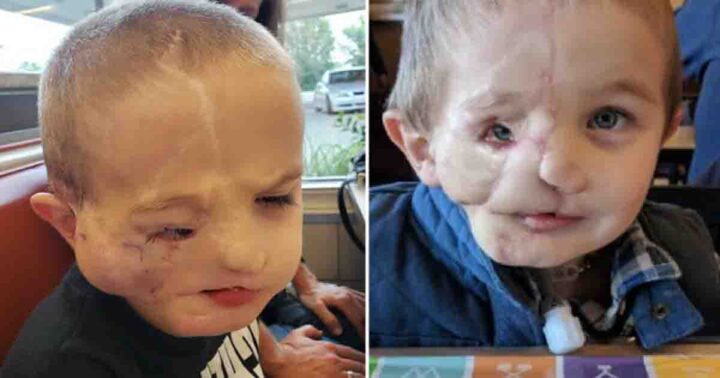 5-year-old boy endures brutal assault by pair of dogs, faces public ridicule as 'monster'