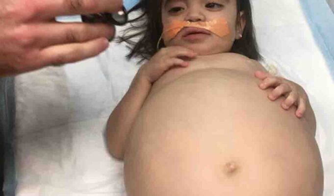Little girl receives a life-saving kidney transplant from her dad