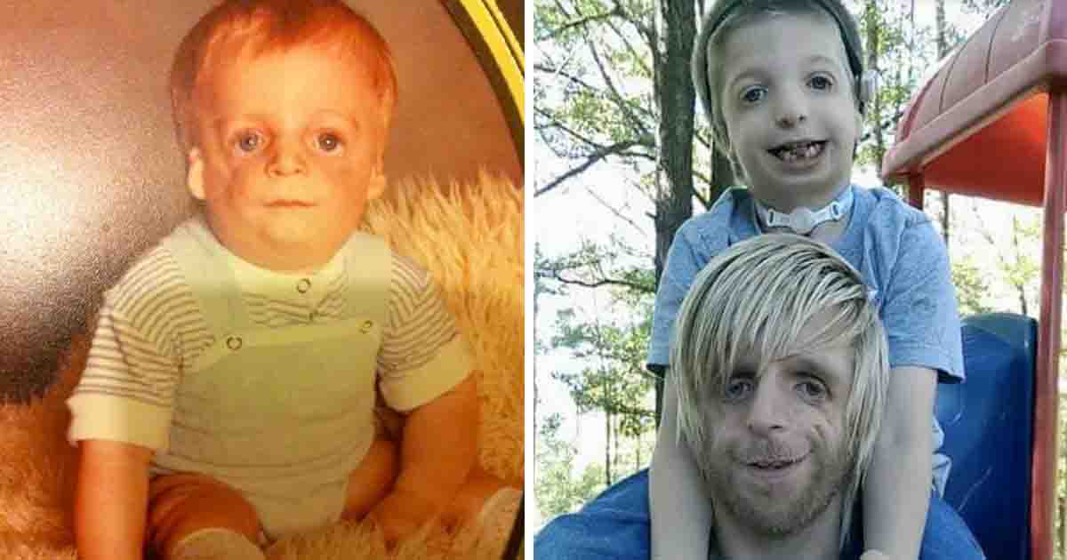 Jono Lancaster's inspiring life story touches hearts everywhere