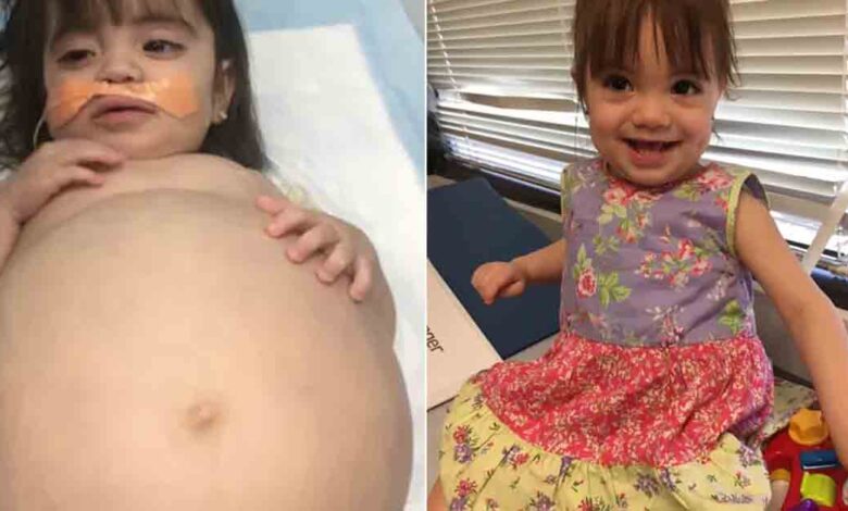 Young girl saved by dad's kidney donation after deadly disease made her look 8 months pregnant