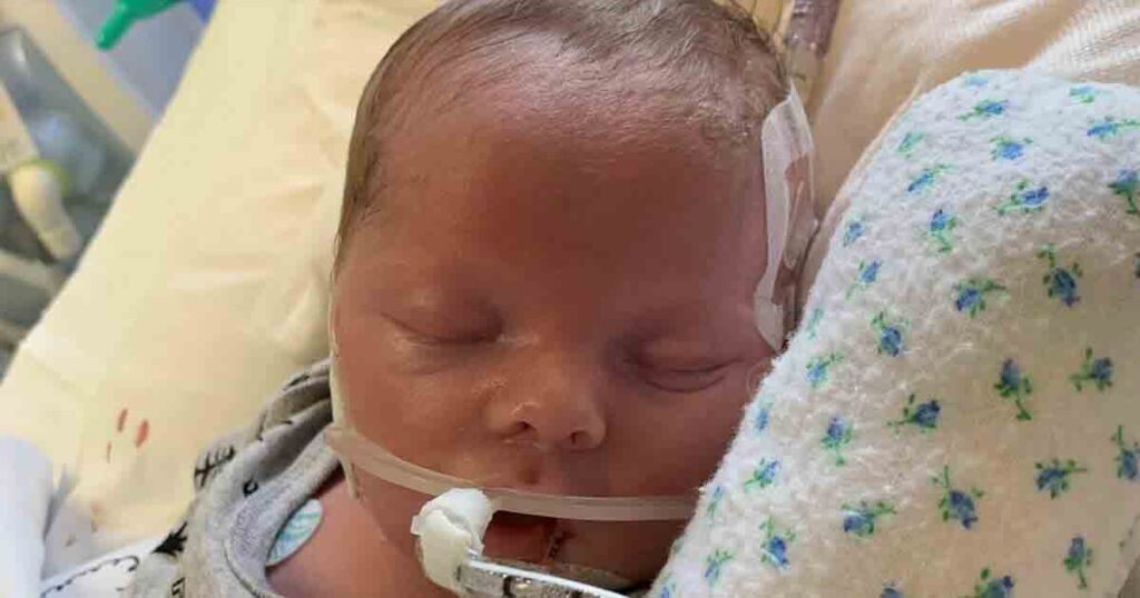 Parents say farewell to newborn as life support is turned off – then he starts breathing on his own
