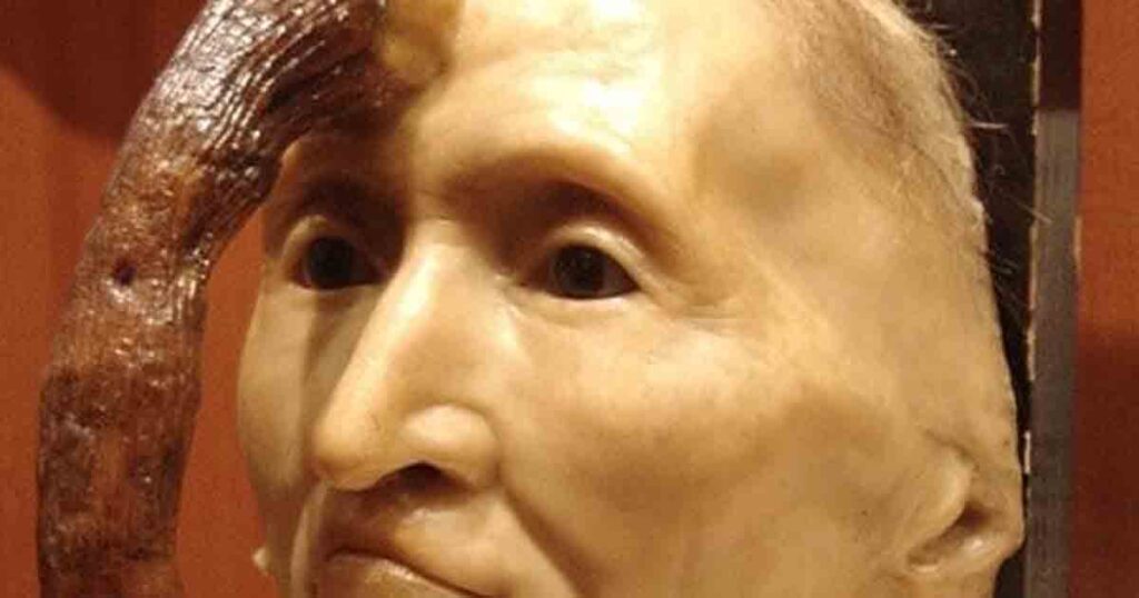 The incredible tale of Madame Dimanche, the woman from Paris who grew a horn