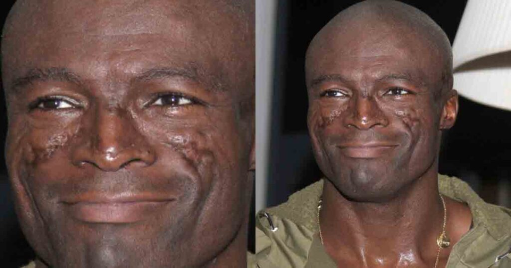 Seal’s iconic face scars explained—Why they’ve been with him for over 30 years