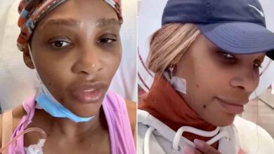 Serena Williams recovering after doctors remove grapefruit-sized cyst from her neck