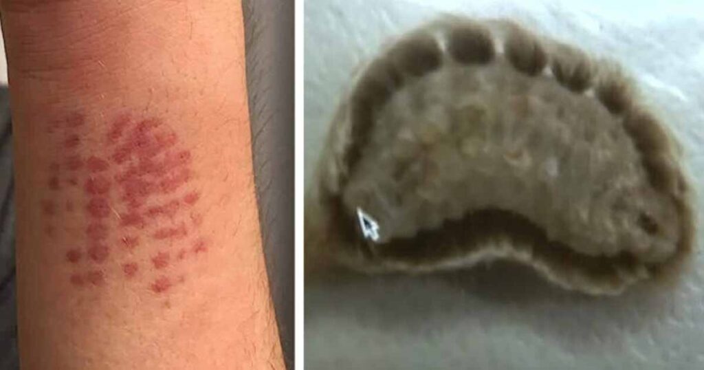 If you see this insect in your yard, don’t ignore it—here’s why