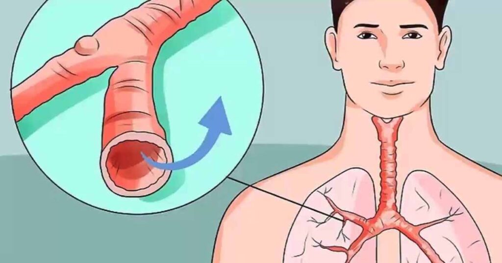 How to keep mucus and phlegm at a healthy level