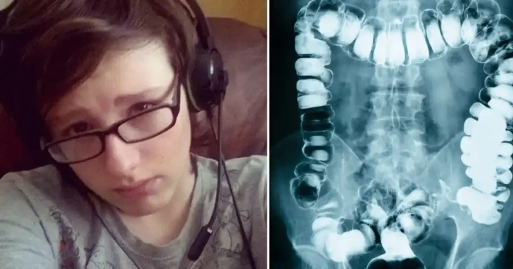 He went to the ER with stomach pain—24 hours later, he was dead