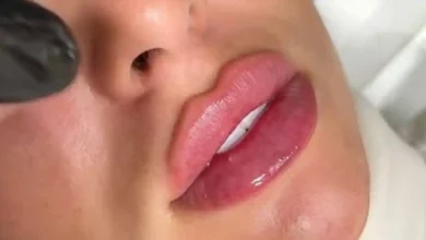 Beverly Hills surgeon reveals shocking truth about dermal fillers and ‘pillow face’ risk