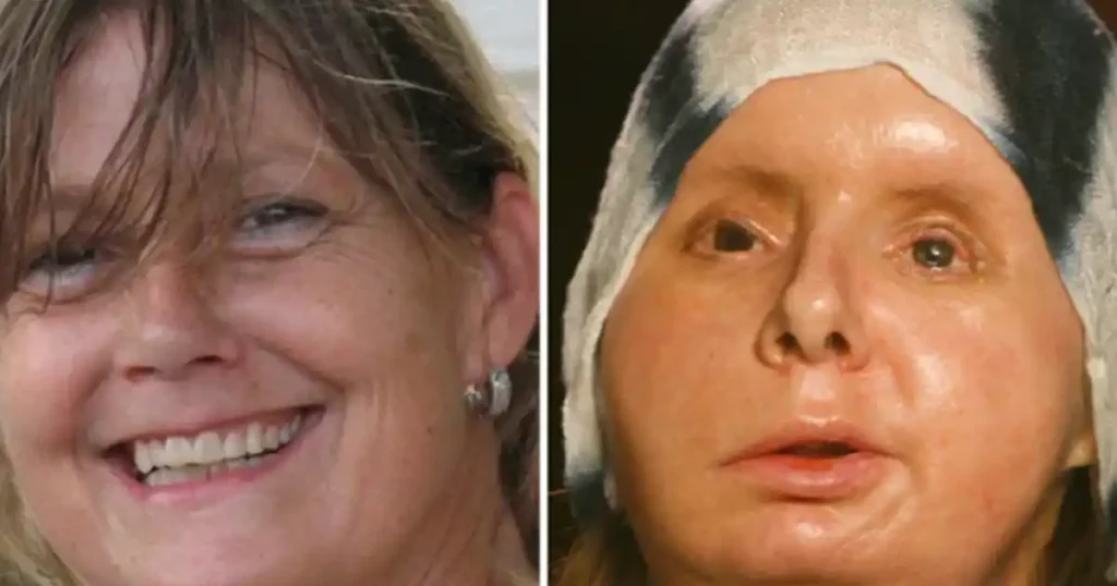 The heartbreaking story of Charla Nash — the woman who survived a chimpanzee attack