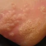 Why wearing used shoes can damage your feet: Here’s what you need to know