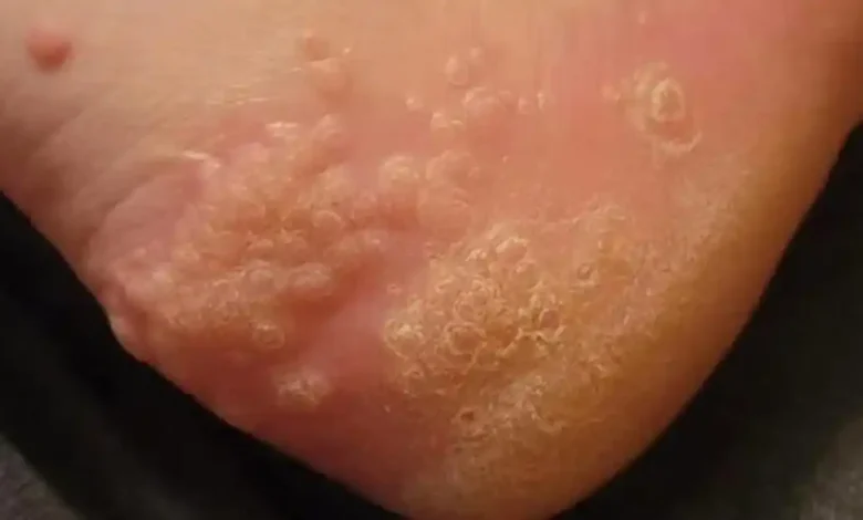 Why wearing used shoes can damage your feet: Here’s what you need to know