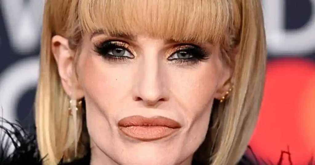 Kelly Osbourne responds to backlash over BRIT Awards weight loss