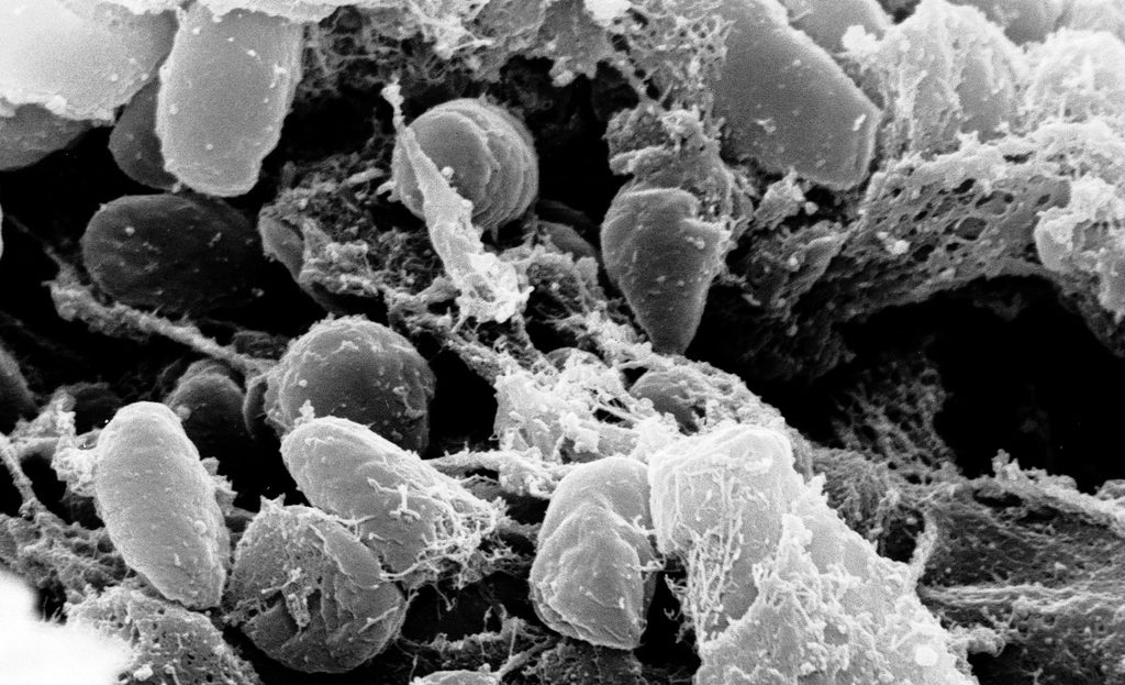 A scanning electron micrograph depicting a mass of Yersinia pestis bacteria