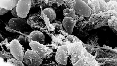 WHO Speaks After Russian Lab Worker Dies of Suspected Pneumonic Plague