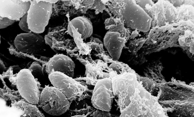 WHO Speaks After Russian Lab Worker Dies of Suspected Pneumonic Plague